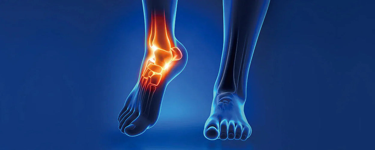 Understanding Ankle Injuries
